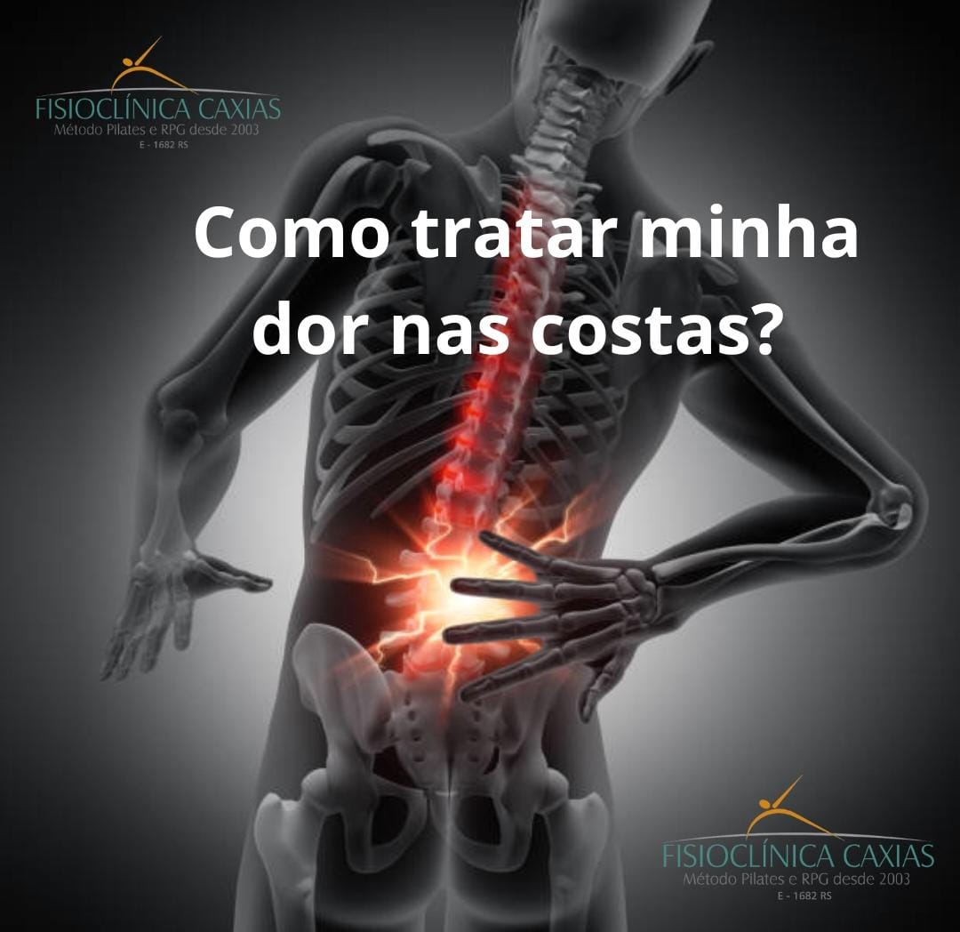 Como tratar minha dor nas costas? - Fisioclínica Caxias